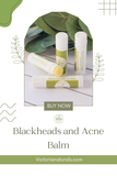 Blackheads and Acne Balm
